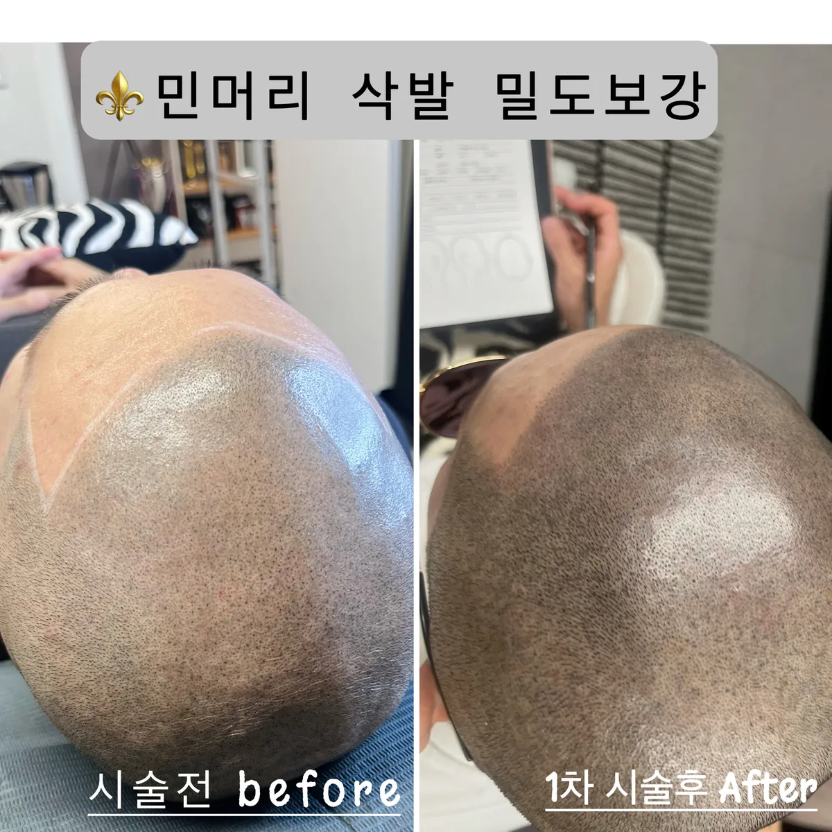 이미지 9