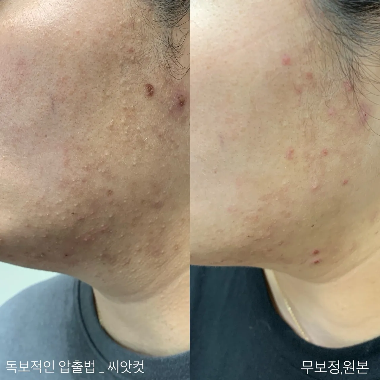이미지 5