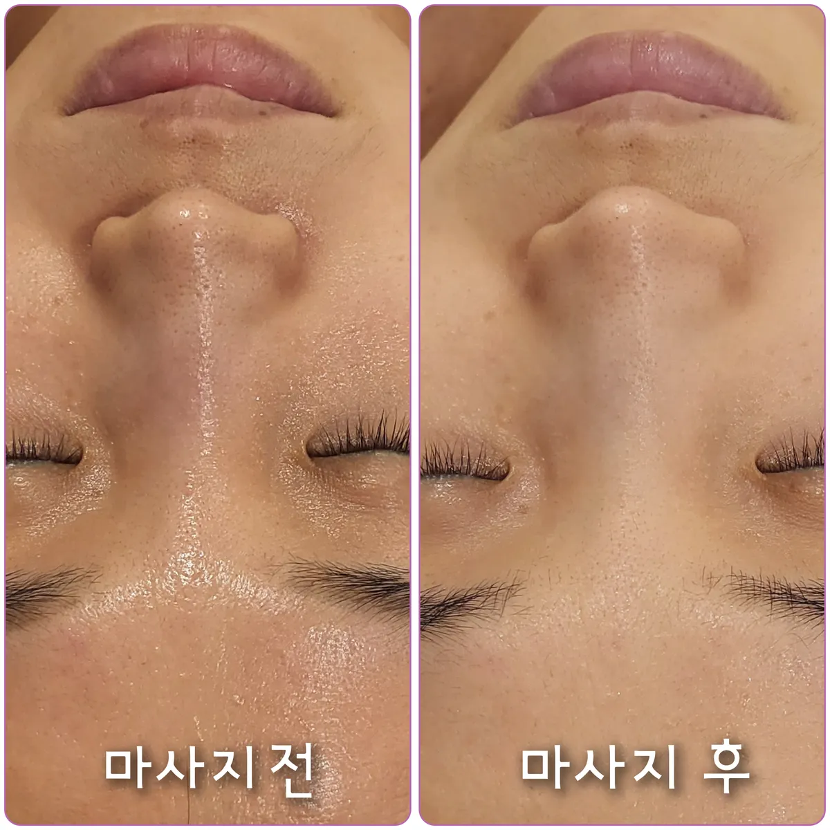 이미지 5