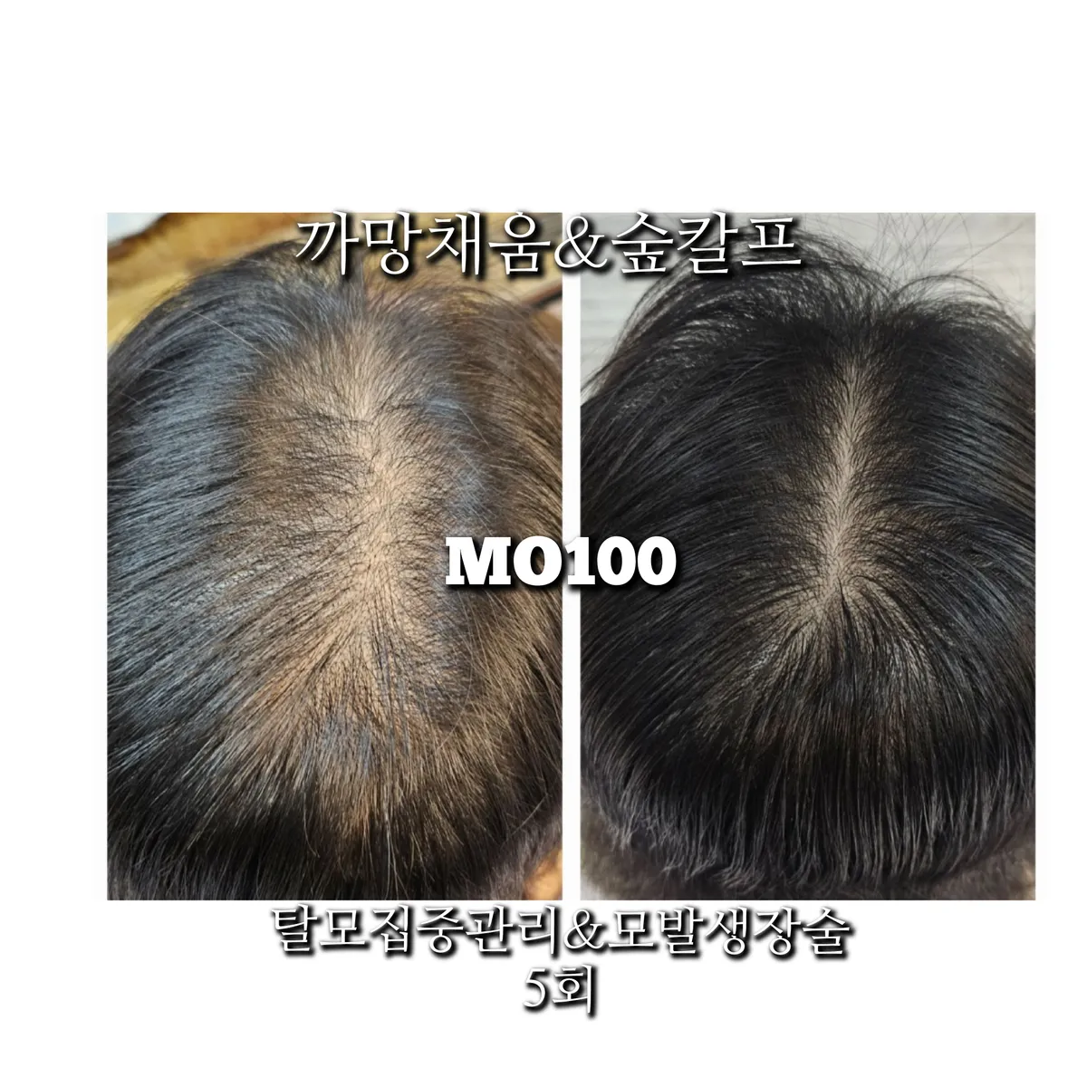 이미지 3