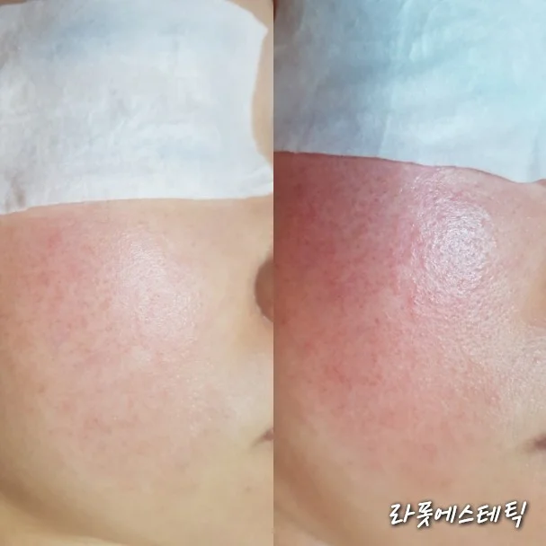 이미지 9