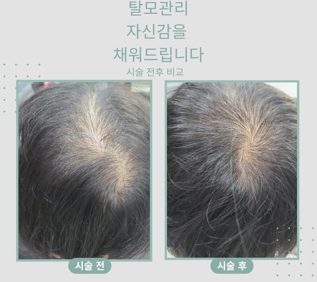 이미지 7