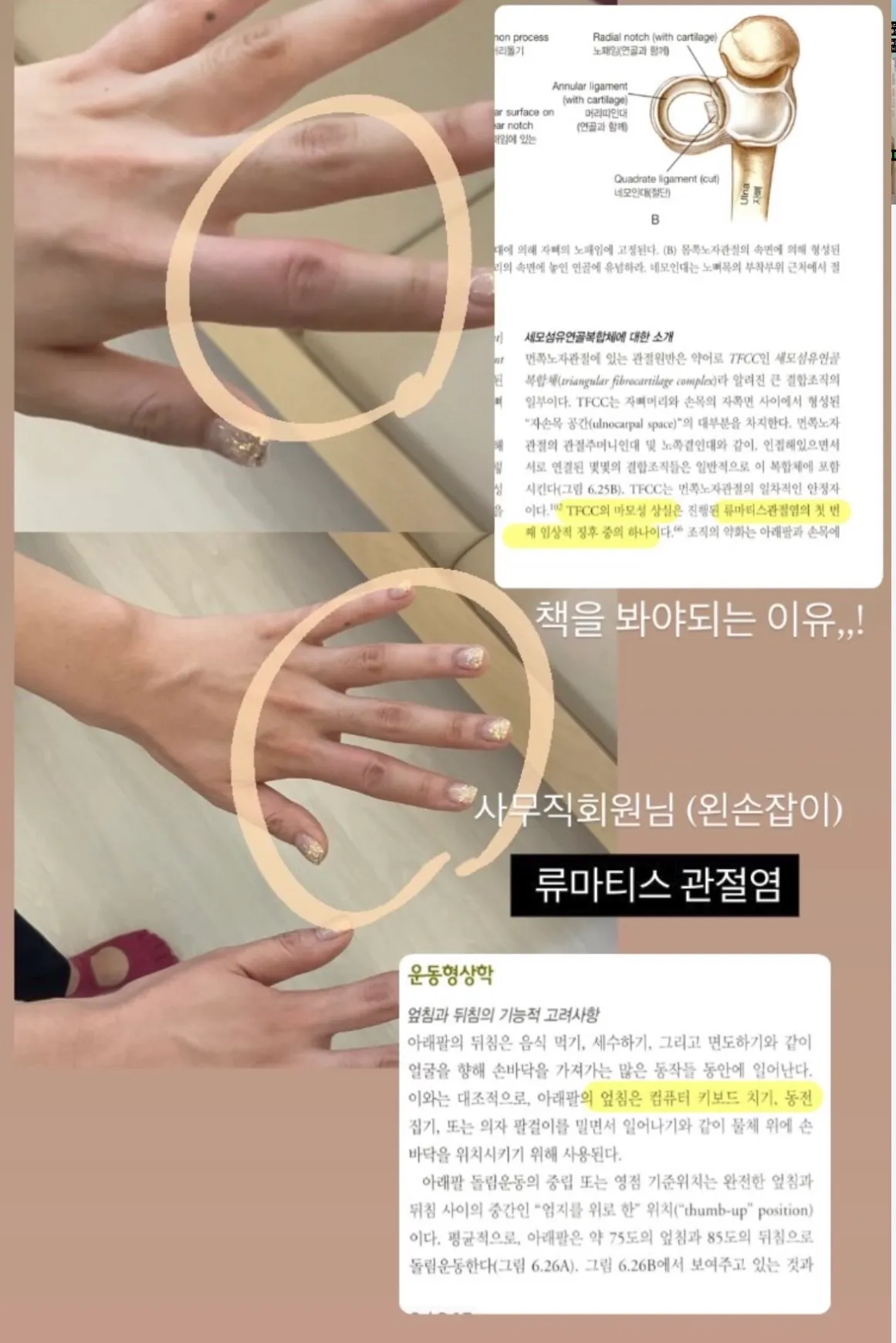이미지 10