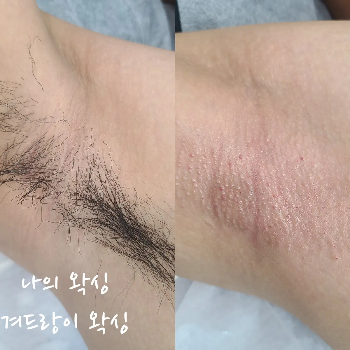 이미지 10
