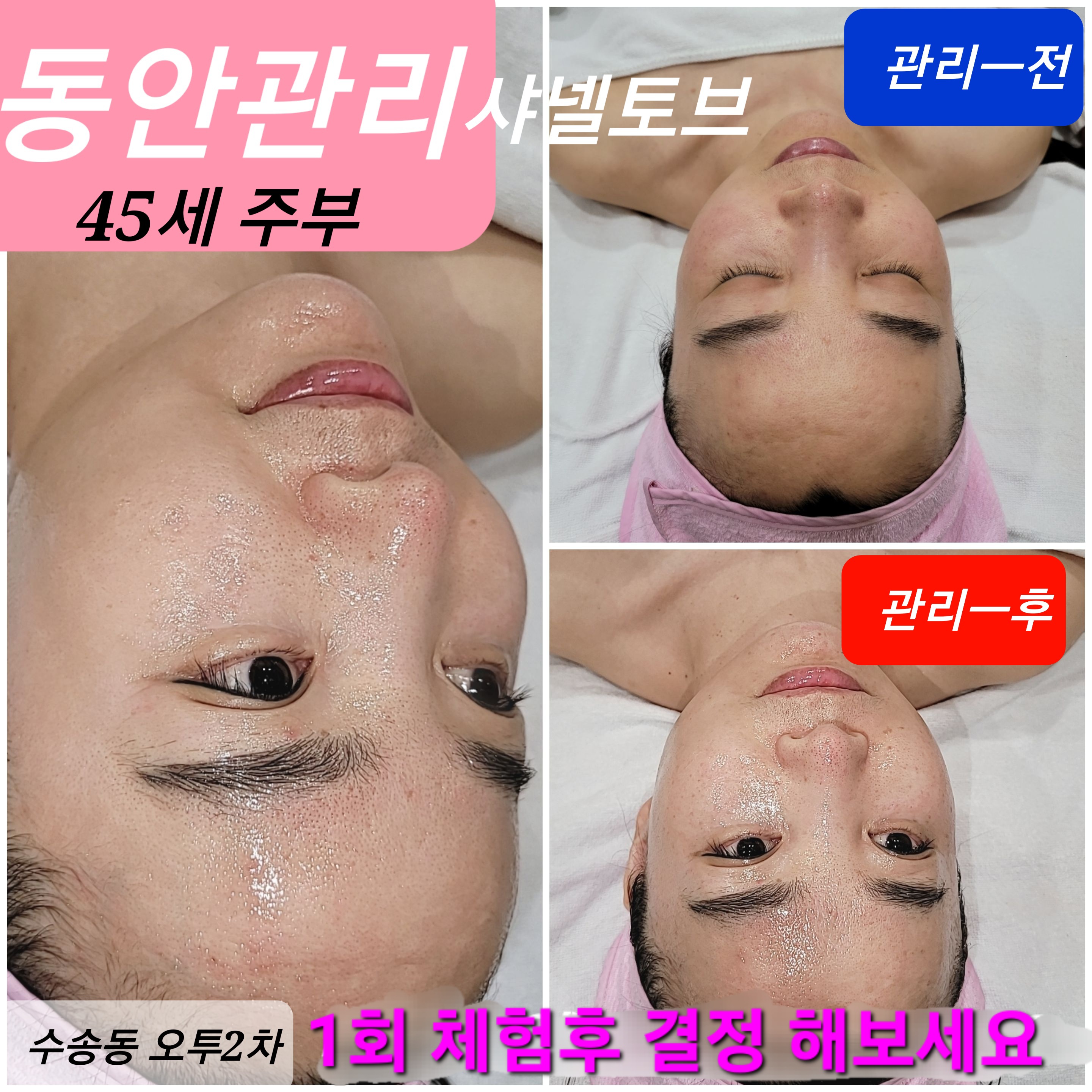 이미지 3