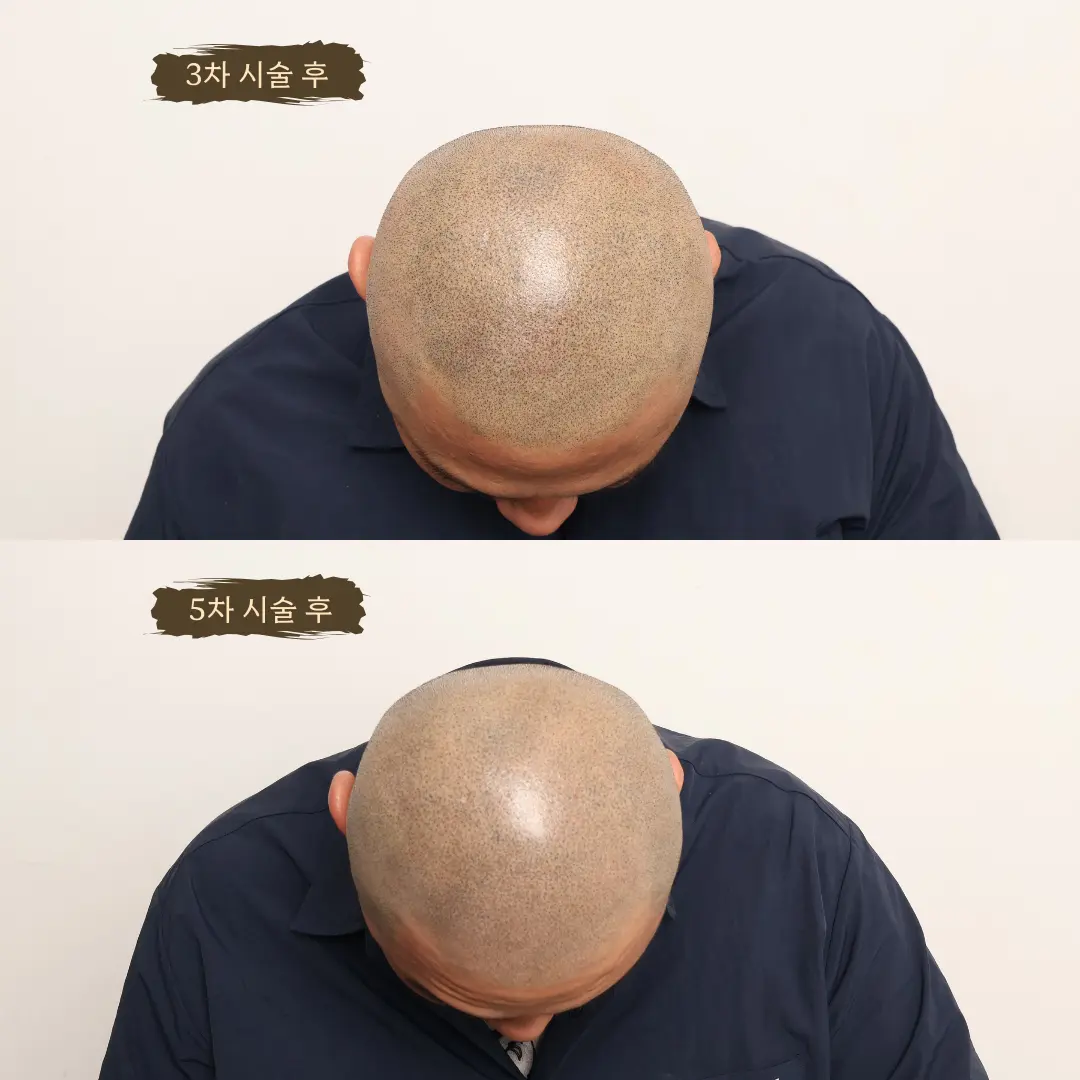 이미지 16