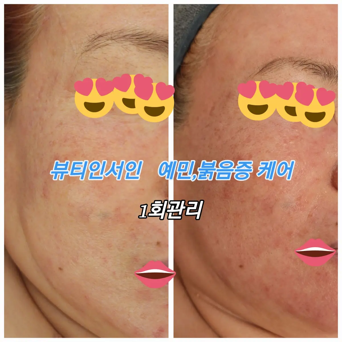 이미지 6