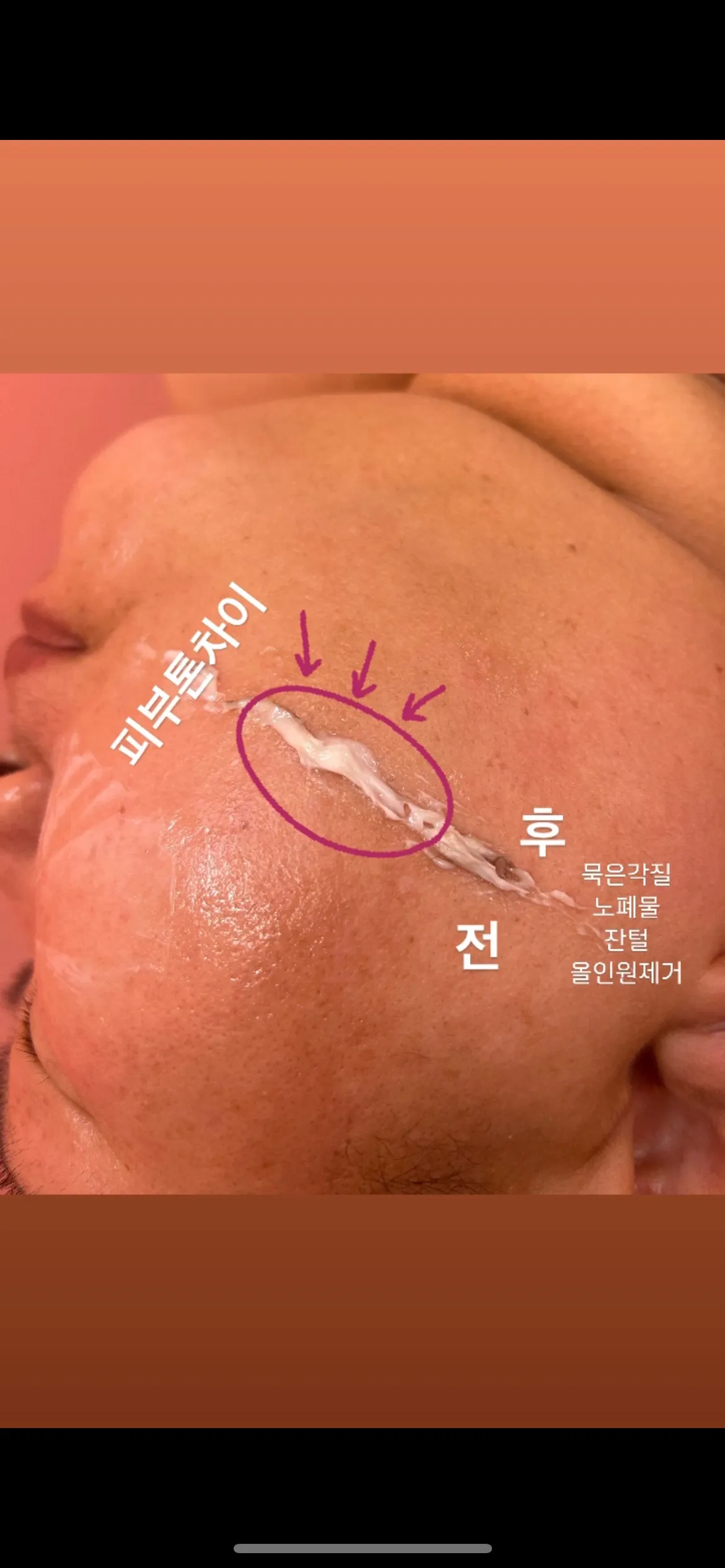 이미지 12