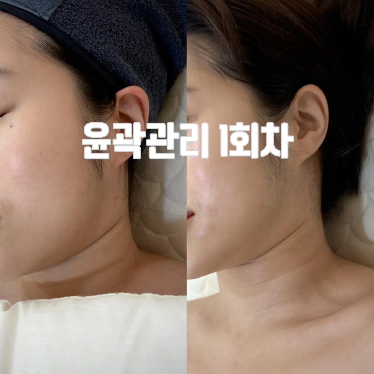이미지 6