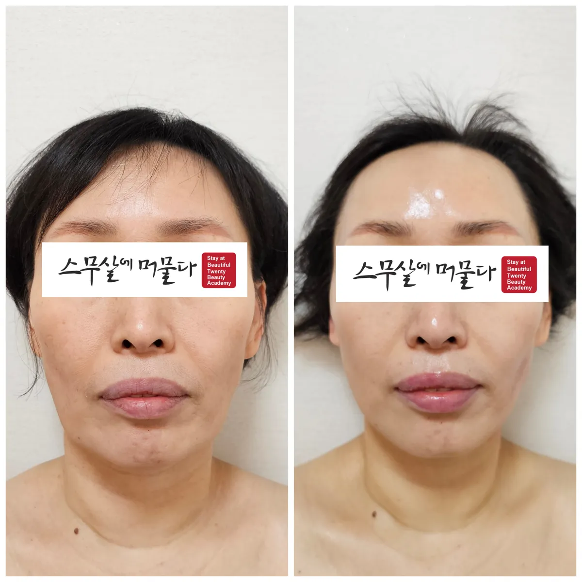 이미지 9