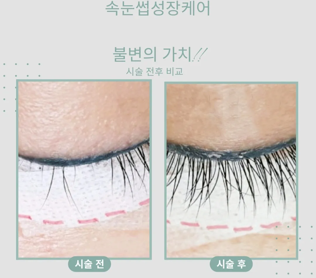 이미지 5