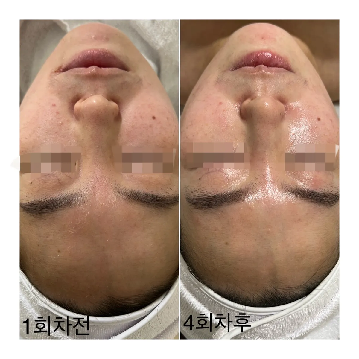 이미지 3