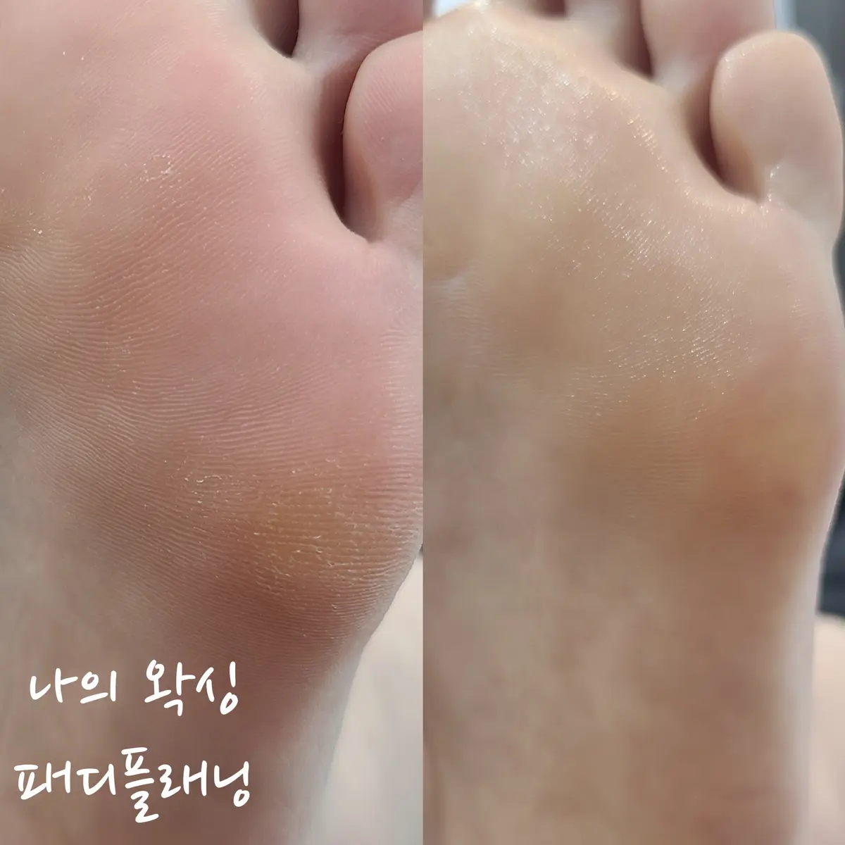 이미지 8