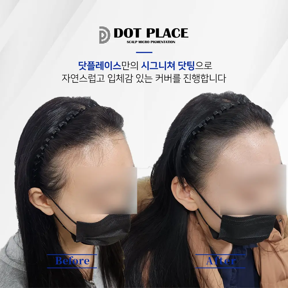이미지 10