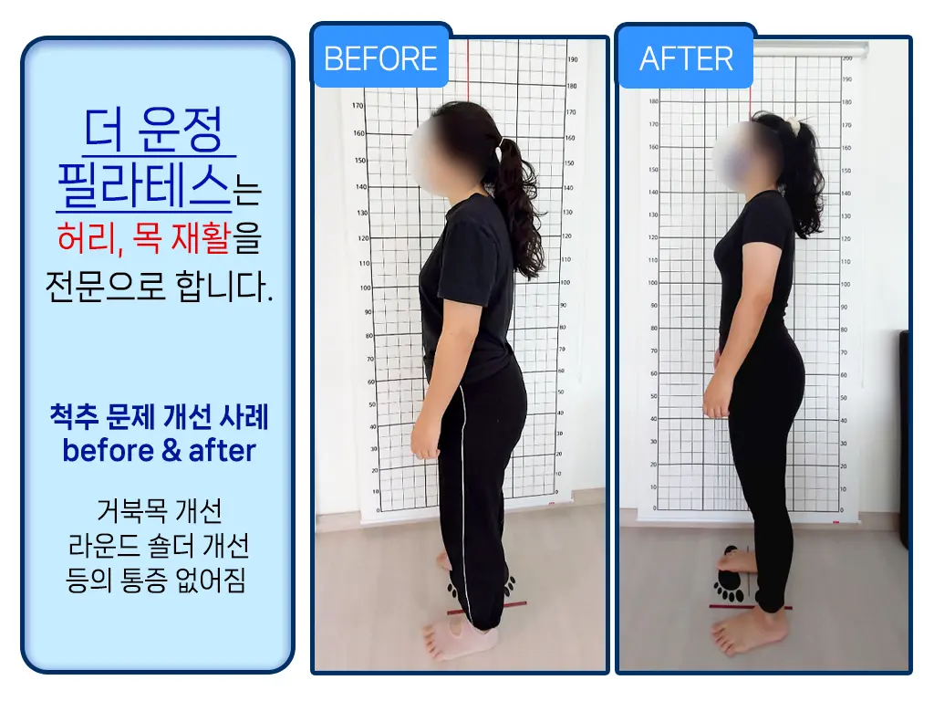 이미지 5