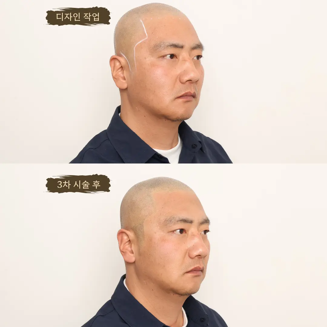 이미지 12
