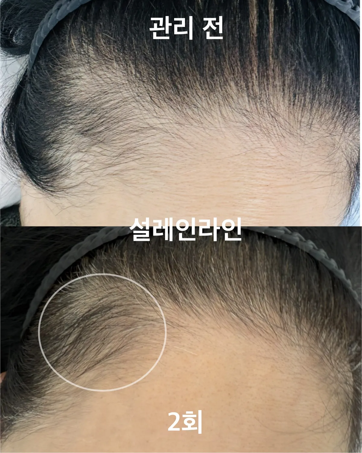 이미지 2