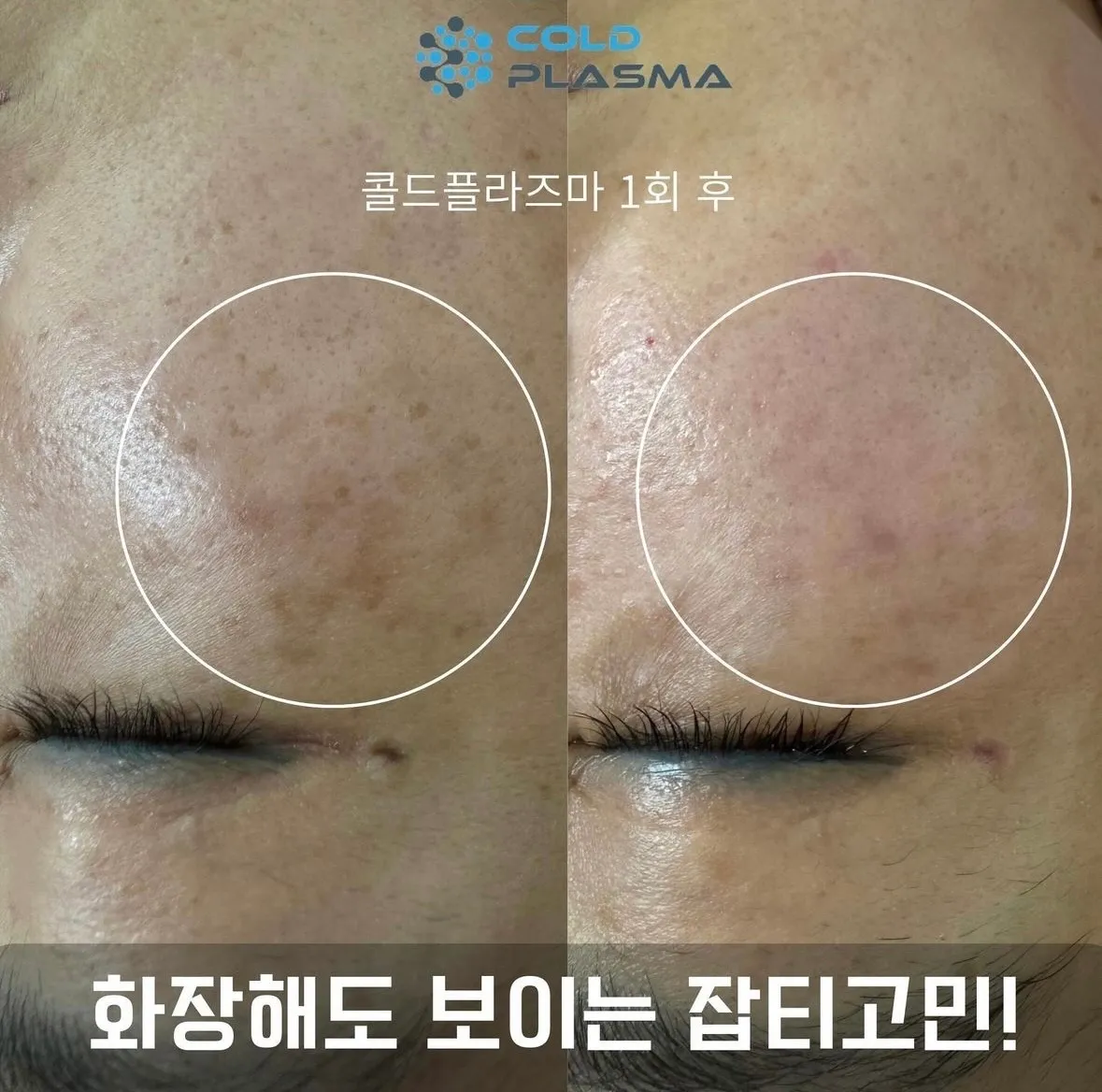 이미지 8