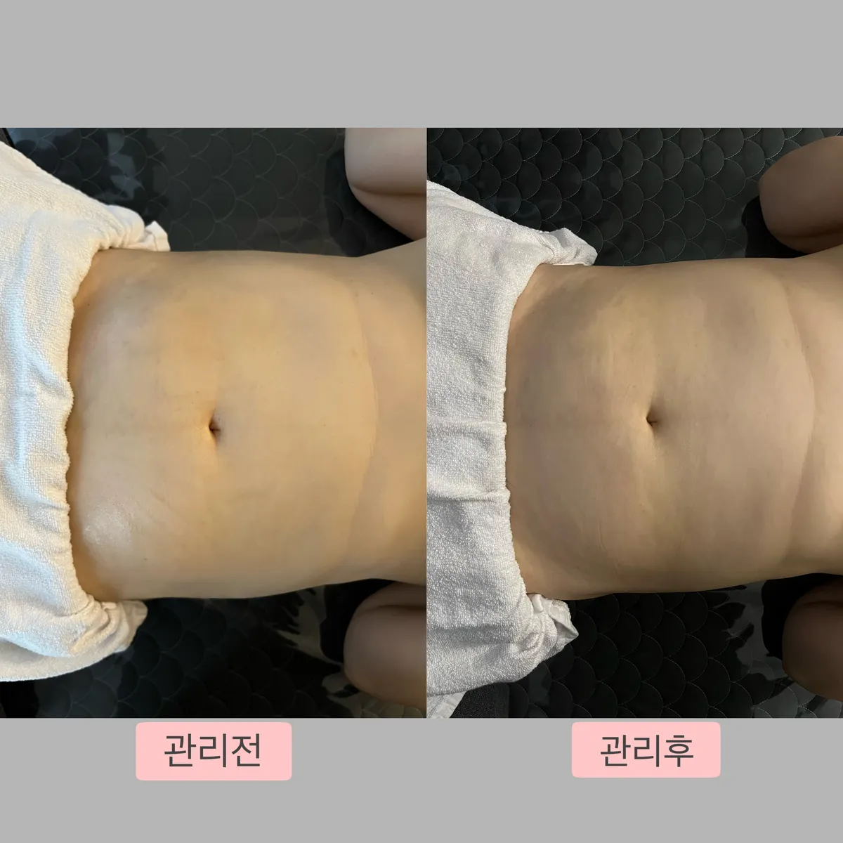 이미지 5