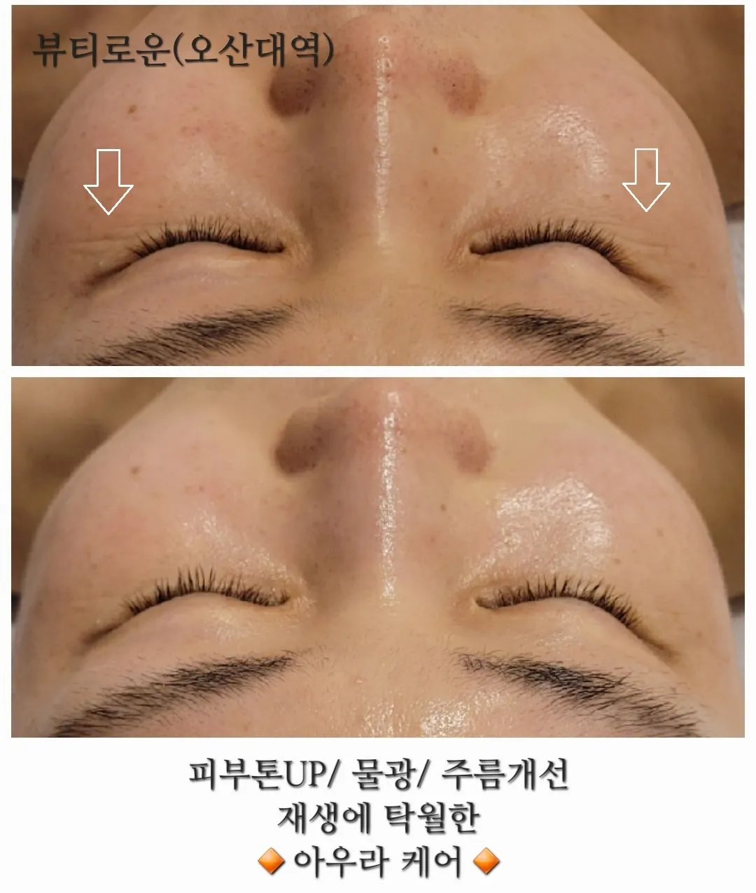 이미지 2