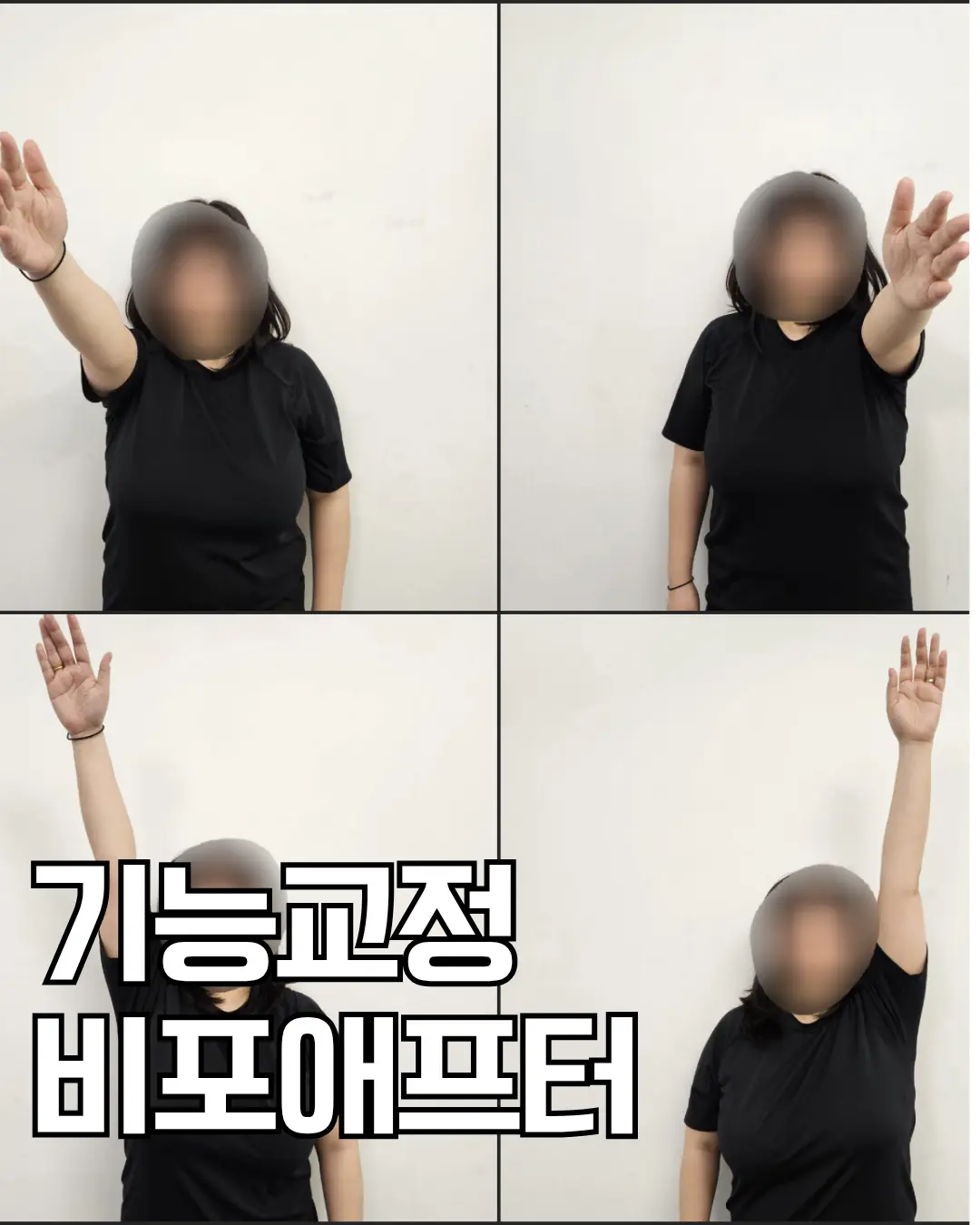 이미지 2