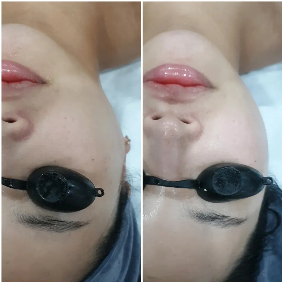 이미지 8