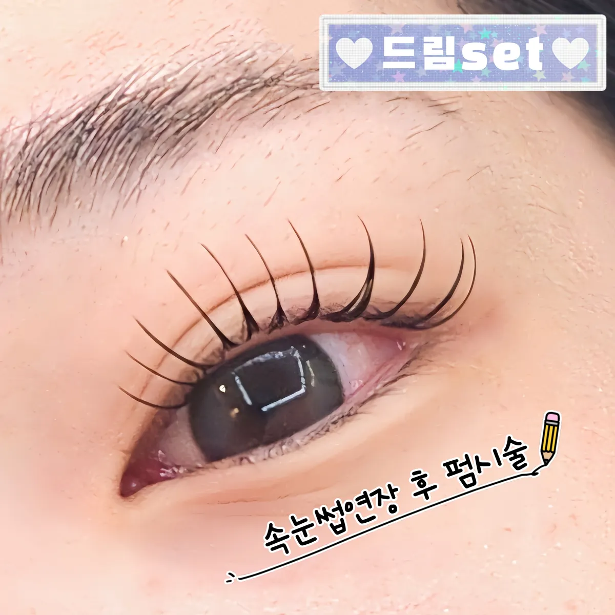이미지 5