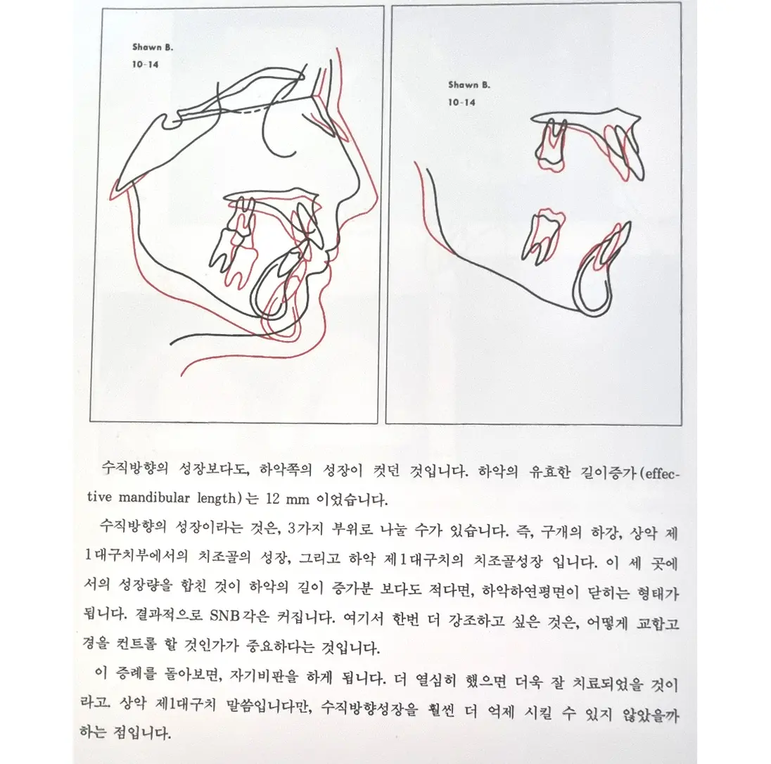 이미지 5