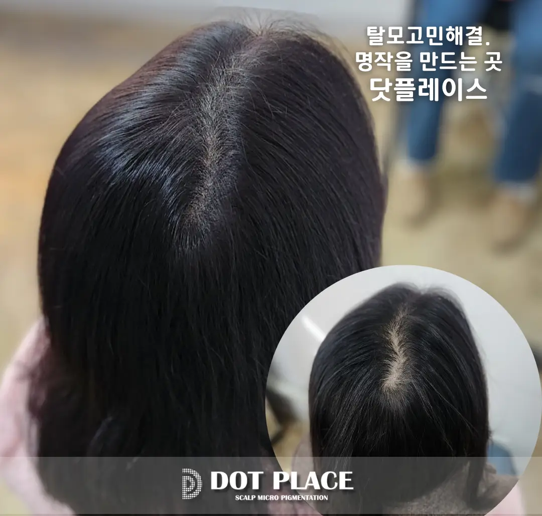 이미지 4