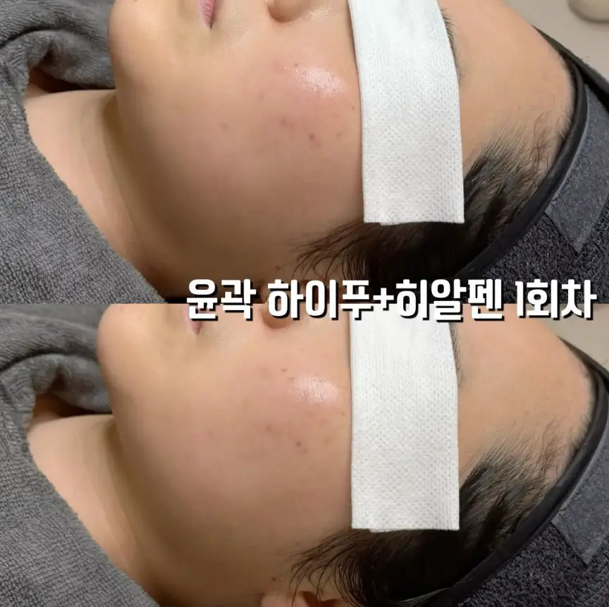 이미지 2