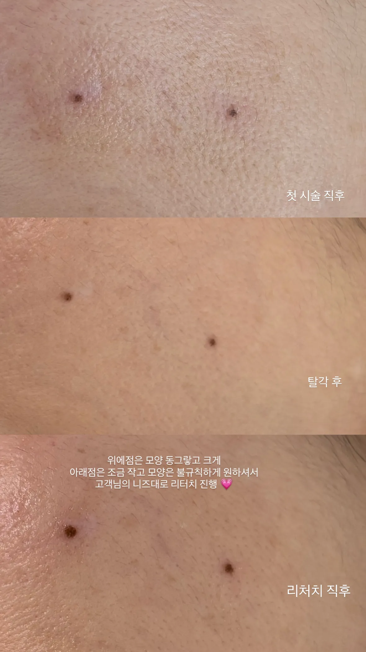 이미지 6