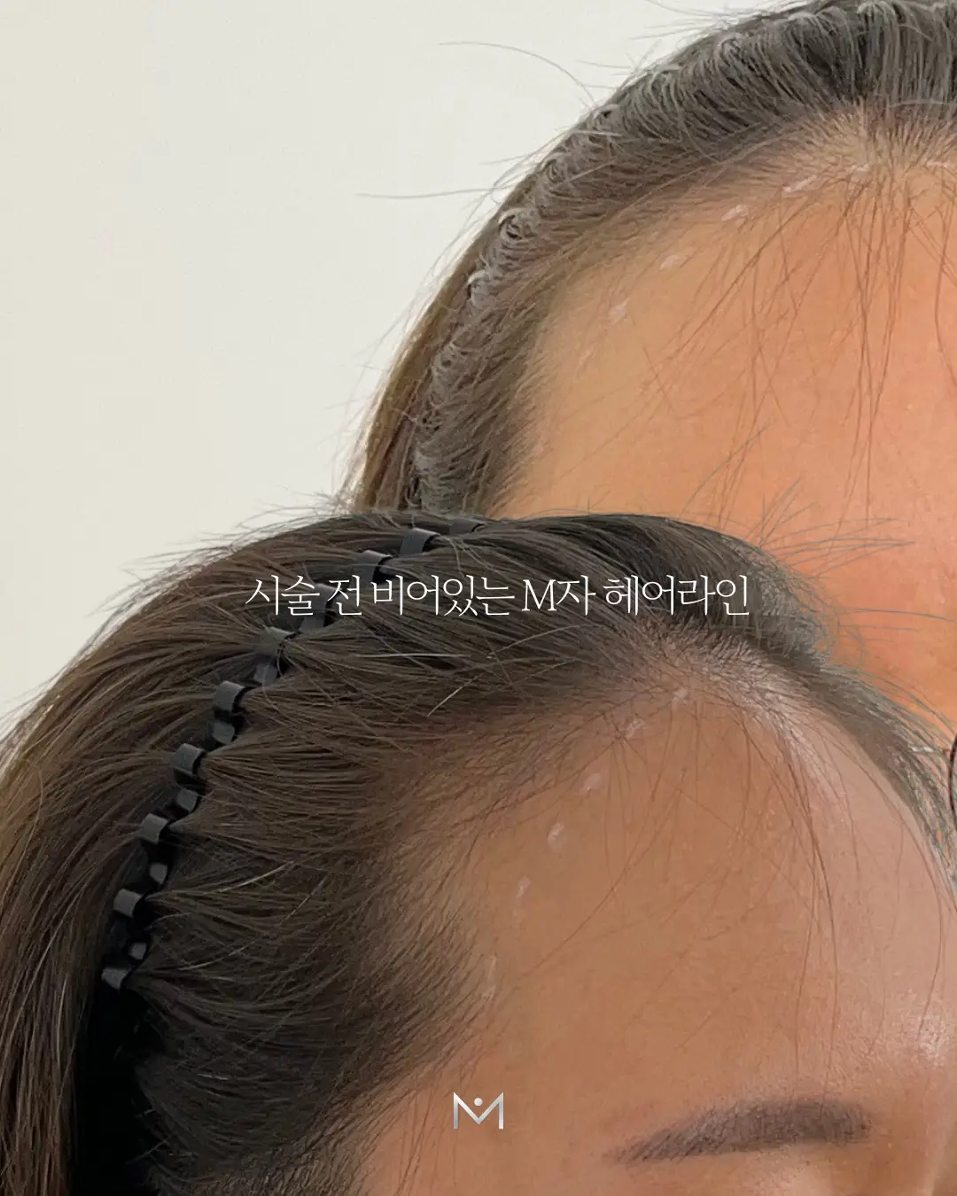 이미지 20
