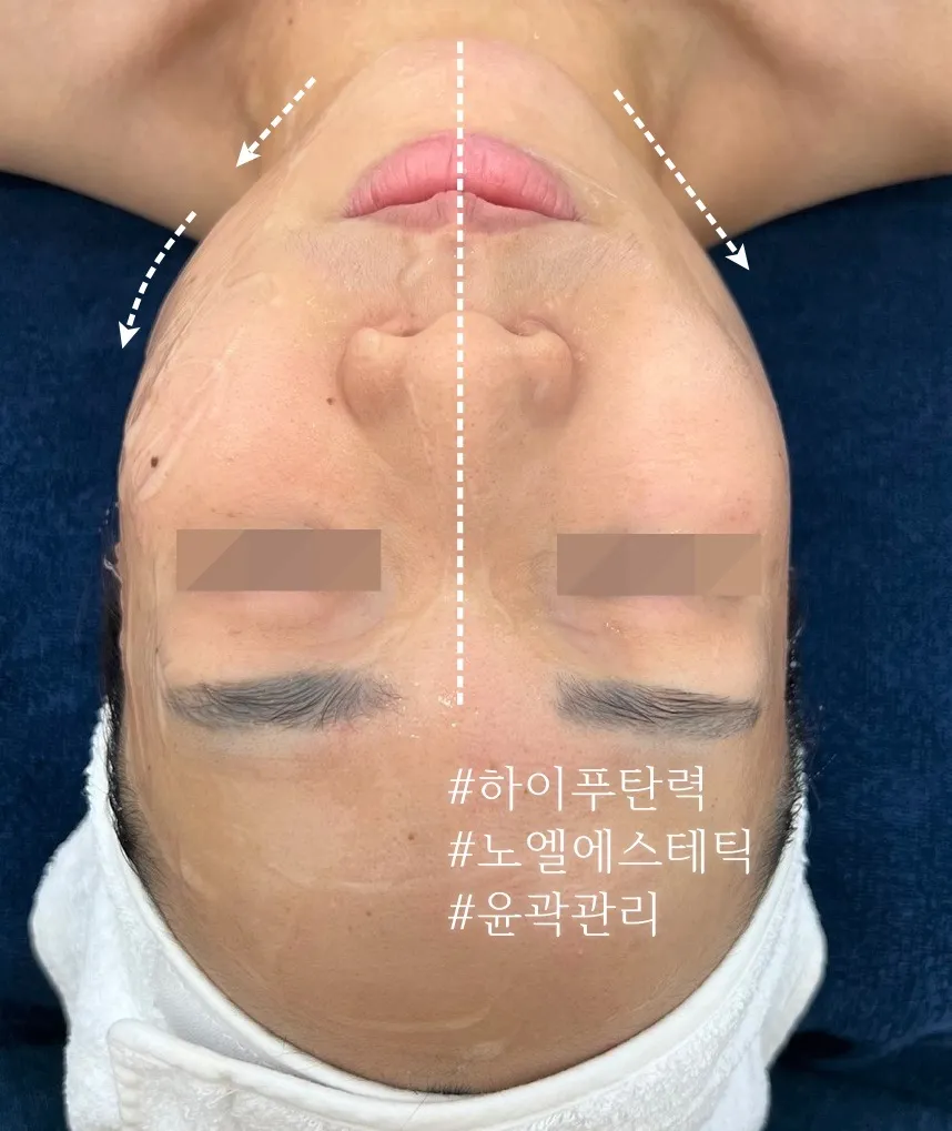 이미지 3