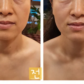 얼굴 경락으로 완성하는 입체적인 윤곽과 빛나는 피부