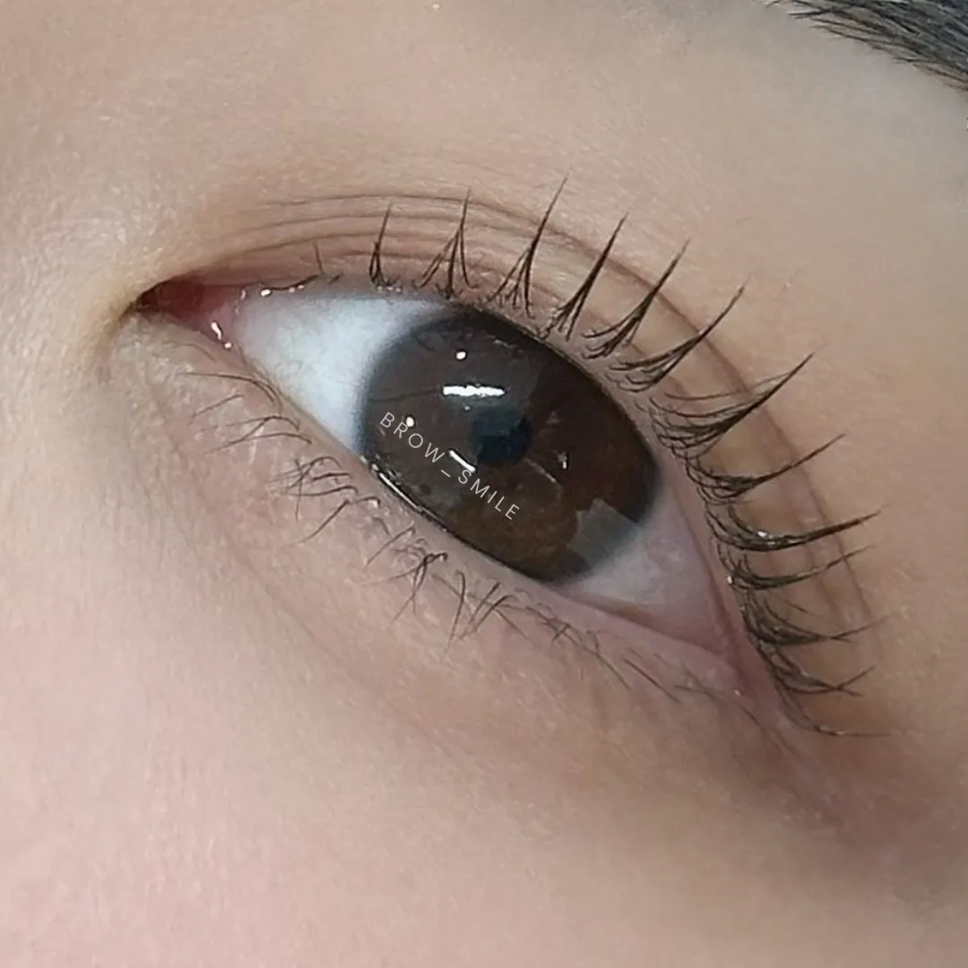 이미지 2