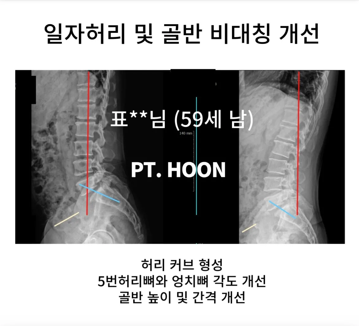 이미지 4