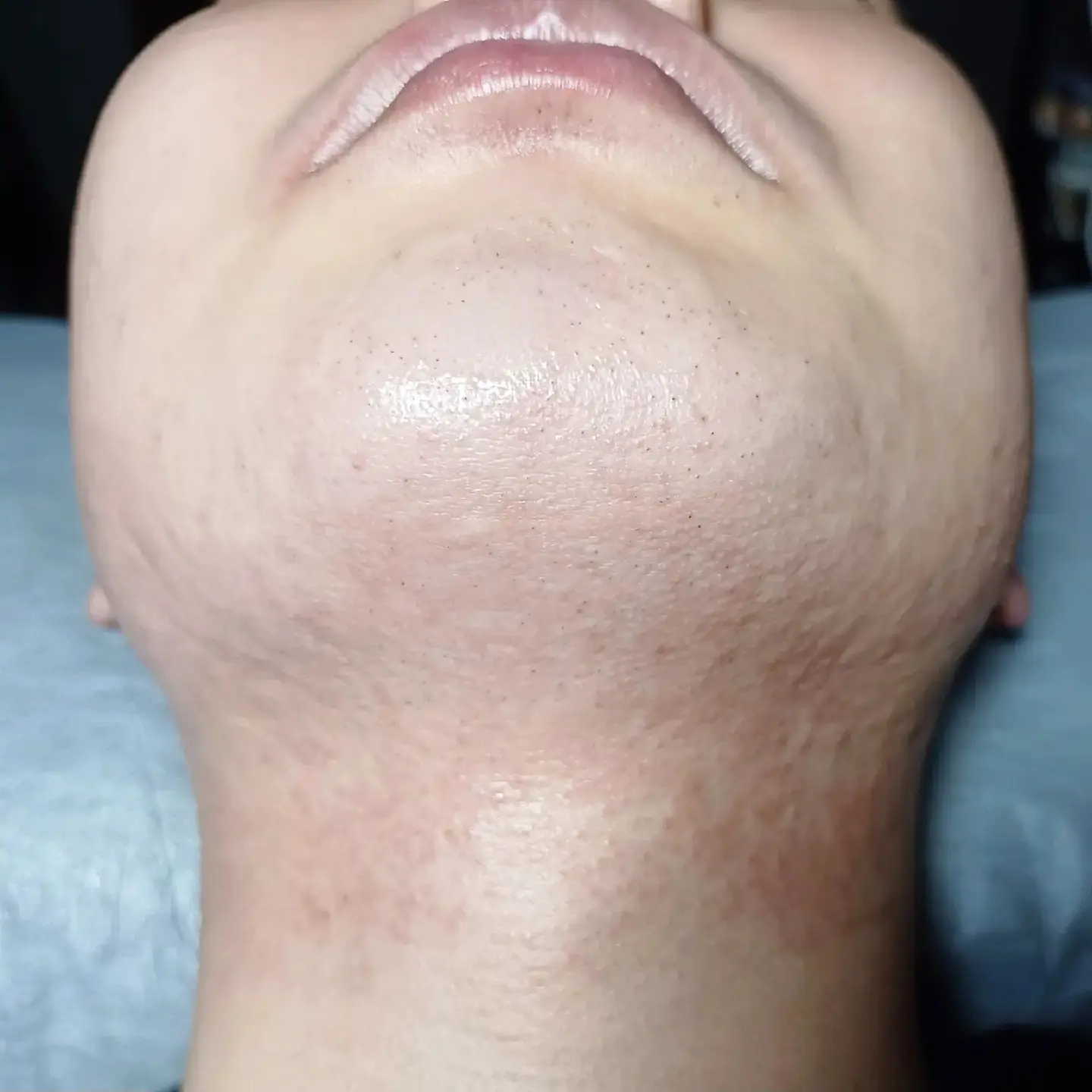 이미지 6