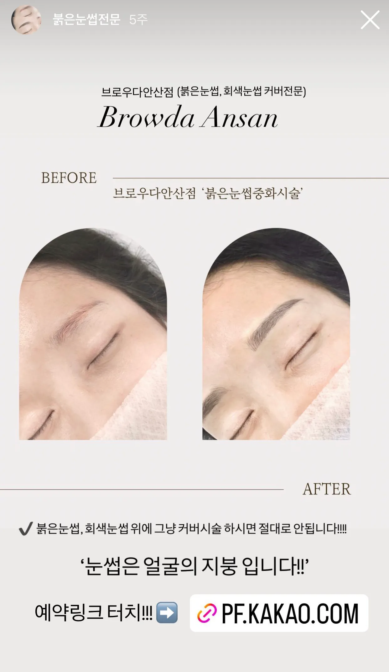 반영구 눈썹 / 브로우다 / 안산시흥송산신도시 반영구전문 - 숨고, 숨은고수 반영구 눈썹