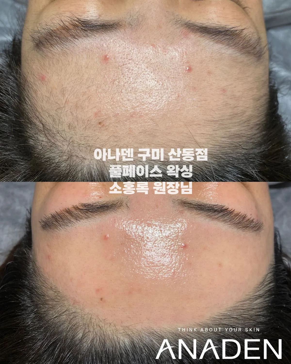 이미지 7