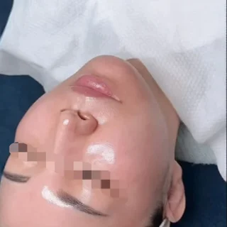 양자 진단 슈퍼젝션으로 주름·탄력·톤 동시 개선! 라라라뷰티의 맞춤 피부 솔루션