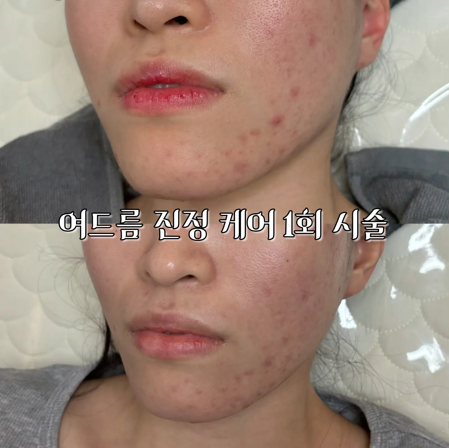 이미지 3