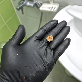 싱크대 물을 쓰면 화장실로 역류! 결국 아랫집 천장 열고 배관 청소한 현장