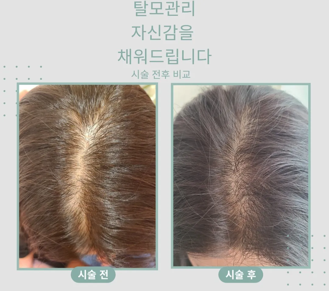 이미지 6