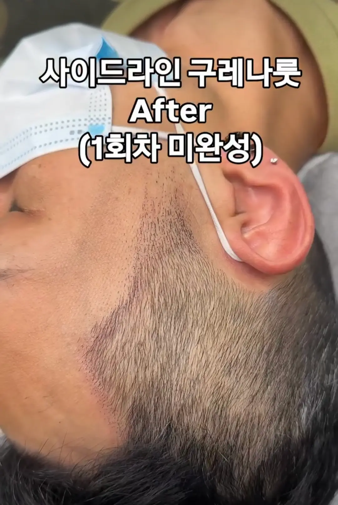 이미지 30