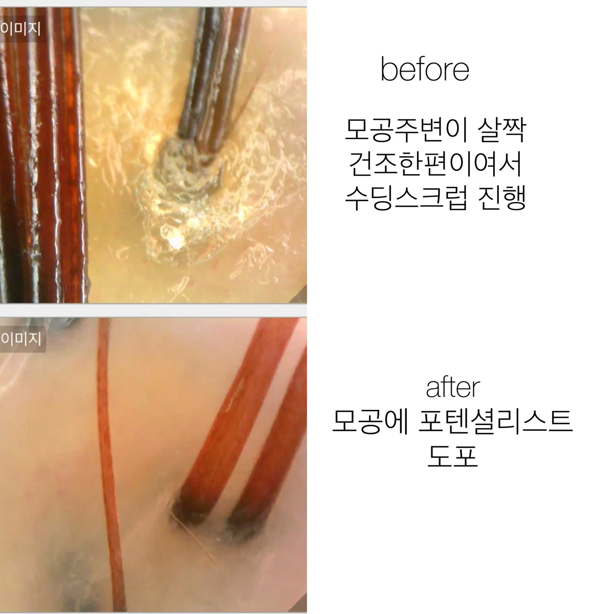 이미지 6