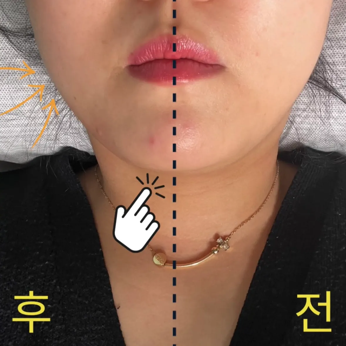 이미지 3