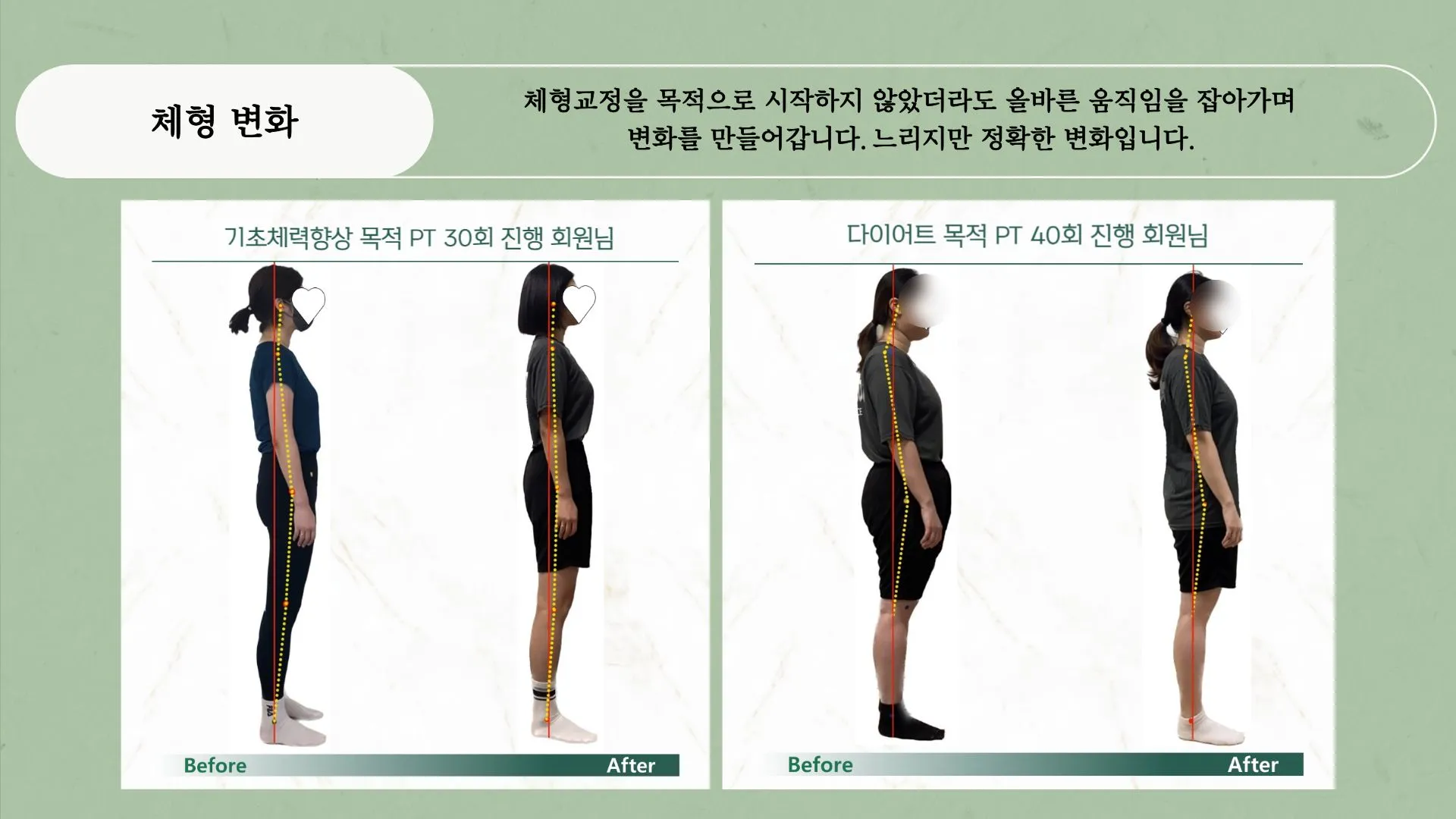 이미지 28