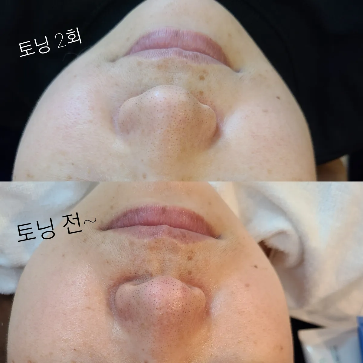 이미지 8