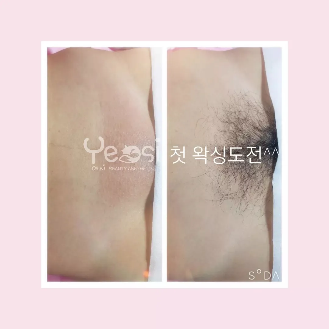 이미지 3