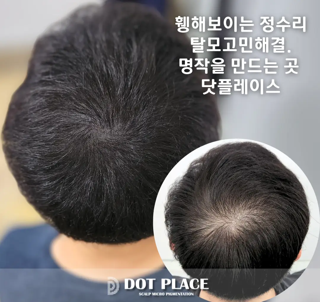 이미지 6